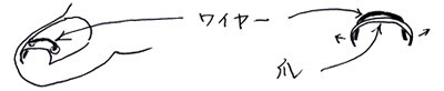 武蔵野市 巻き爪治療
